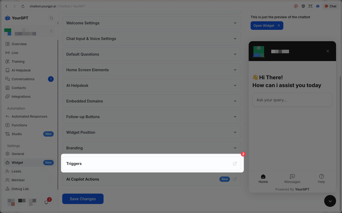 Open Triggers section